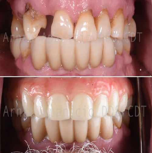 Dental implants. Teeth whitening-17